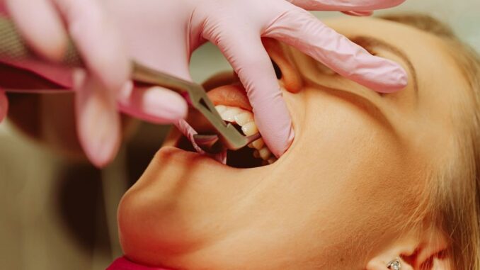 dental implant dental implant