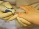 ingrown toenail relief houston